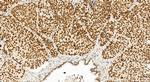 NSD3 Antibody in Immunohistochemistry (Paraffin) (IHC (P))