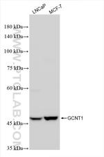 GCNT1 Antibody in Western Blot (WB)