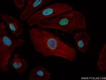 JUND Antibody in Immunocytochemistry (ICC/IF)
