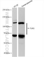 TLR3 Antibody in Western Blot (WB)