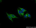 RNF31/HOIP Antibody in Immunocytochemistry (ICC/IF)