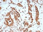 BAP1 (BRCA1 Associated Protein 1) Recombinant Rabbit Monoclonal Antibody (BAP1/8959R)
