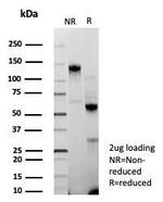 BAP1 (BRCA1 Associated Protein 1) Recombinant Rabbit Monoclonal Antibody (BAP1/9120R)