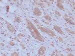 BAP1 (BRCA1 Associated Protein 1) Recombinant Rabbit Monoclonal Antibody (BAP1/9795R)