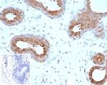 BAP1 (BRCA1 Associated Protein 1) Antibody in Immunohistochemistry (Paraffin) (IHC (P))