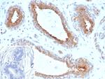BAP1 (BRCA1 Associated Protein 1) Antibody in Immunohistochemistry (Paraffin) (IHC (P))