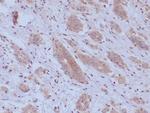 BAP1 (BRCA1 Associated Protein 1) Antibody in Immunohistochemistry (Paraffin) (IHC (P))