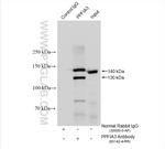 PPFIA3 Antibody in Immunoprecipitation (IP)