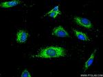 GRP94 Antibody in Immunocytochemistry (ICC/IF)