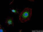 GRP94 Antibody in Immunocytochemistry (ICC/IF)