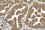 GRP94 Antibody in Immunohistochemistry (Paraffin) (IHC (P))