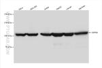 GRP94 Antibody in Western Blot (WB)