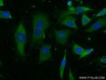 TIMP1 Antibody in Immunocytochemistry (ICC/IF)