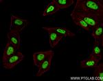 HOXB6 Antibody in Immunocytochemistry (ICC/IF)