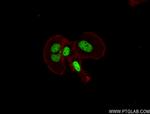 HOXB6 Antibody in Immunocytochemistry (ICC/IF)