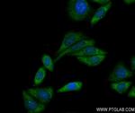 TYK2 Antibody in Immunocytochemistry (ICC/IF)