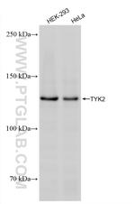 TYK2 Antibody in Western Blot (WB)