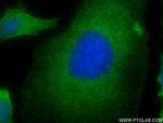 ROCK1 Antibody in Immunocytochemistry (ICC/IF)