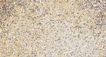 ROCK1 Antibody in Immunohistochemistry (Paraffin) (IHC (P))