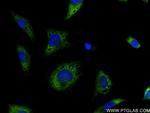TGFB2 Antibody in Immunocytochemistry (ICC/IF)
