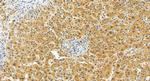 TGFB2 Antibody in Immunohistochemistry (Paraffin) (IHC (P))