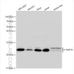 SAR1A Antibody in Western Blot (WB)