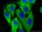 SAR1A Antibody in Immunocytochemistry (ICC/IF)
