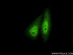 SMAD4 Antibody in Immunocytochemistry (ICC/IF)