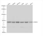 SMAD4 Antibody in Western Blot (WB)