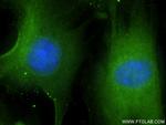 TRIM54 Antibody in Immunocytochemistry (ICC/IF)
