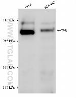 TPR Antibody in Western Blot (WB)