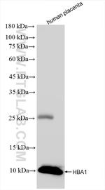 HBA1 Antibody in Western Blot (WB)