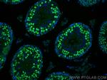 SMC6 Antibody in Immunohistochemistry (PFA fixed) (IHC (PFA))