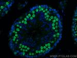 SMC6 Antibody in Immunohistochemistry (PFA fixed) (IHC (PFA))