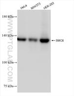SMC6 Antibody in Western Blot (WB)