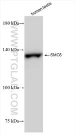 SMC6 Antibody in Western Blot (WB)