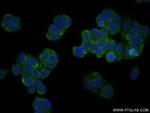 MMP13 Antibody in Immunocytochemistry (ICC/IF)