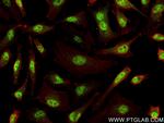 HIRA Antibody in Immunocytochemistry (ICC/IF)