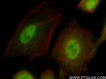 HIRA Antibody in Immunocytochemistry (ICC/IF)