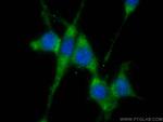MIF Antibody in Immunocytochemistry (ICC/IF)