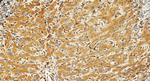 IGFBP4 Antibody in Immunohistochemistry (Paraffin) (IHC (P))