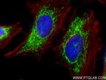 ATP6 Antibody in Immunocytochemistry (ICC/IF)