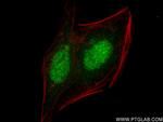 CBP80 Antibody in Immunocytochemistry (ICC/IF)