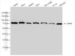 CBP80 Antibody in Western Blot (WB)
