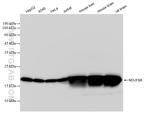 NDUFB8 Antibody in Western Blot (WB)