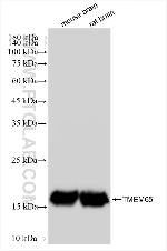 TMEM65 Antibody in Western Blot (WB)