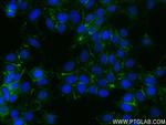 Nectin-4/PVRL4 Antibody in Immunocytochemistry (ICC/IF)