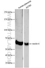 Nectin-4/PVRL4 Antibody in Western Blot (WB)