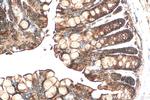 SULT1B1 Antibody in Immunohistochemistry (Paraffin) (IHC (P))