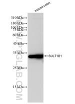 SULT1B1 Antibody in Western Blot (WB)